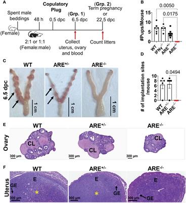 Aberrant CD8+T cells drive reproductive dysfunction in female mice with elevated IFN-γ levels